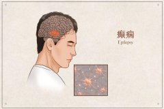 黑龍江省治療癲癇較好的醫院